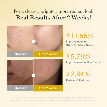 Kojic Acid Turmeric Niacinamide Serum